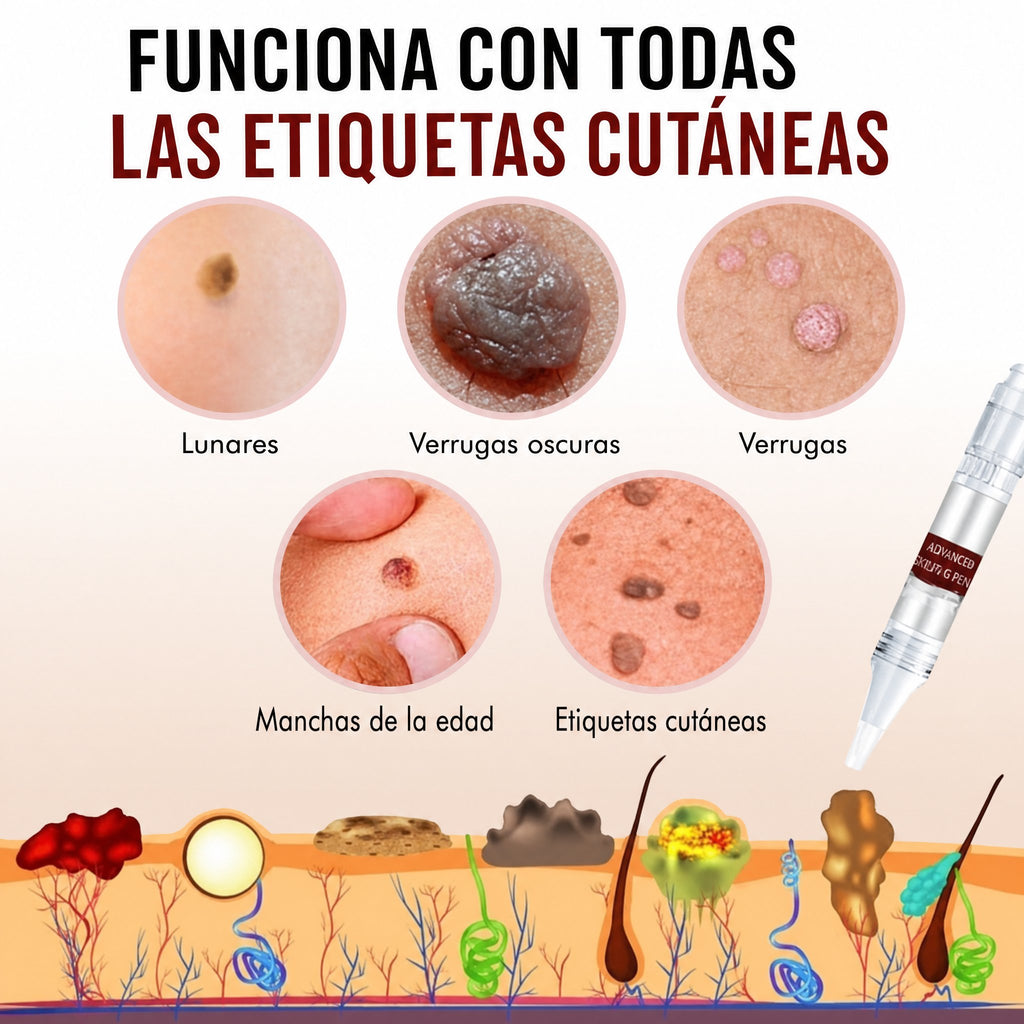 Bolígrafo Natural para Eliminar Marcas y Lunares en la Piel