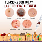 Bolígrafo Natural para Eliminar Marcas y Lunares en la Piel
