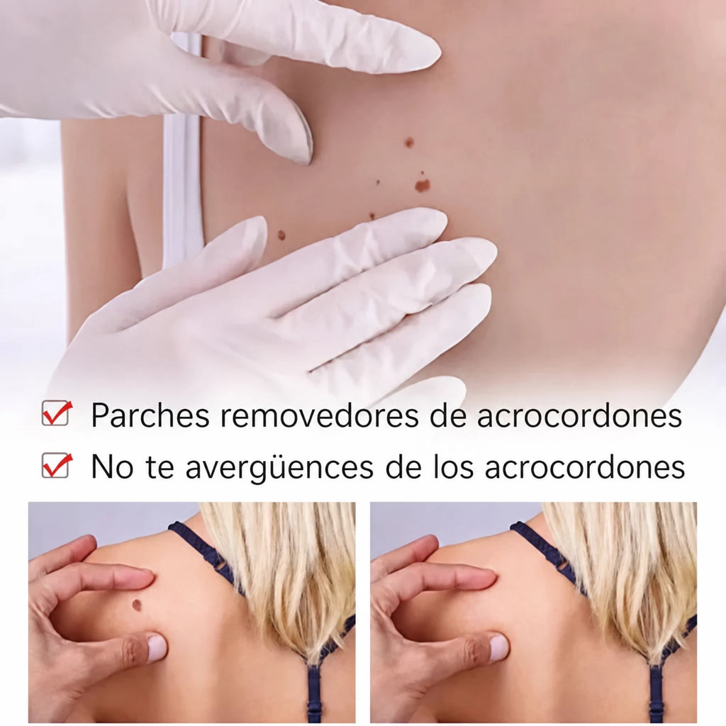Bolígrafo Natural para Eliminar Marcas y Lunares en la Piel