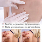 Bolígrafo Natural para Eliminar Marcas y Lunares en la Piel